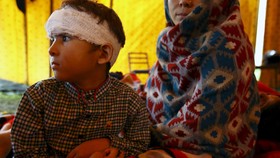 Sekitar 500 Ribu Anak Nepal Terancam Campak