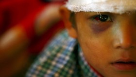 Rawat Korban Gempa, Rumah Sakit di Nepal Mulai Kehabisan Obat