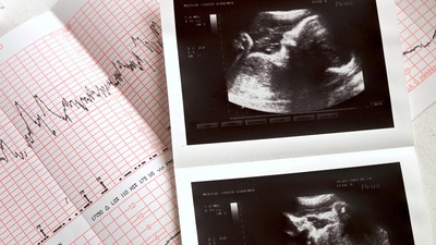 Ibu, Gaya Hidup saat Remaja Bisa Pengaruhi Janin