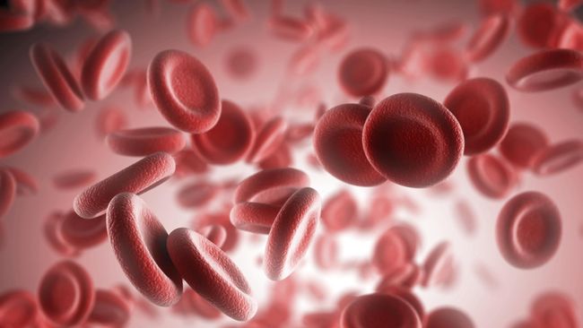 Chronic Myeloid Leukimia (CML) adalah jenis kanker darah yang unik. Di Indonesia pengidapnya banyak yang baru berusia 30-an tahun.