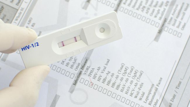 Tidak ada infeksi HIV baru di antara 657 orang yang mengonsumsi pil harian Truvada.