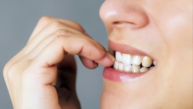 Suka Menggigit Kuku? Bisa Jadi Anda Perfeksionis