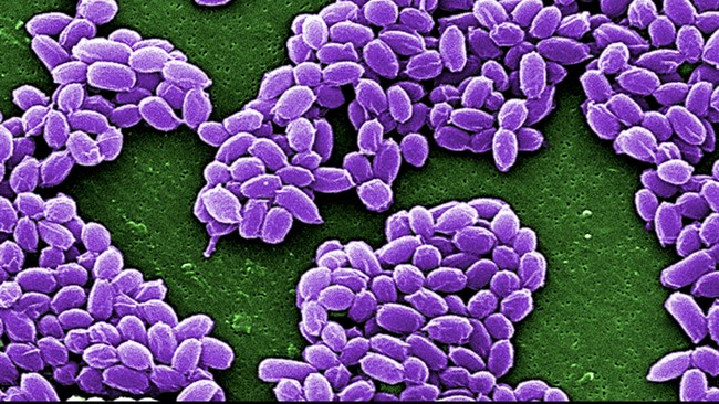 Inggris menjadi salah satu negara yang menerima kiriman sampel bakteri Anthrax hidup dari Departemen Pertahanan Amerika Serikat, Pentagon.