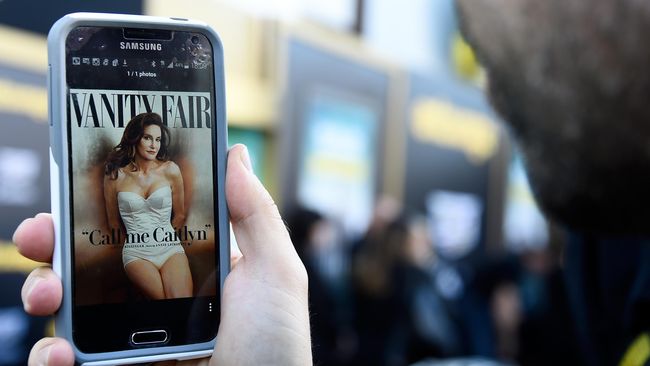Sebelum sesi pemotretan berlangsung, Bruce 'Caitlyn' Jenner dikabarkan melakukan prosedur bedah plastik seharga US$70.000 (Rp 930 juta).