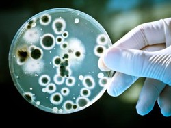 Mengenal Brucellosis, Wabah yang Melanda China di Tengah Pandemi COVID-19