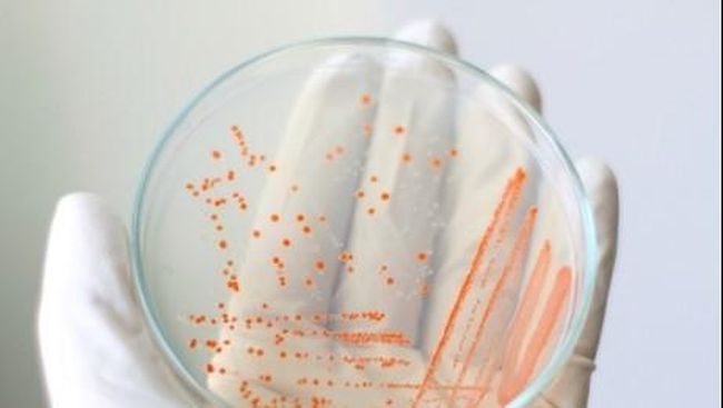 Peneliti Perancis menemukan sebuah virus yang berusia 30 ribu tahun di sebuah lapisan terdalam permafrost yang membeku di Siberia.
