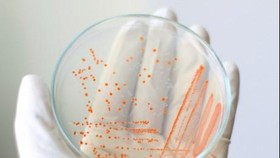 Virus Berusia 30 Ribu Tahun Ditemukan di Siberia