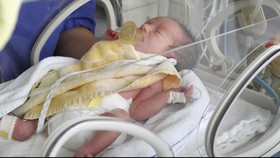 Cara Sederhana Tangani Masalah Pernapasan pada Bayi Prematur