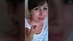 Kuku Ibu Jari yang Menghitam karena Diserang Kanker Ganas
