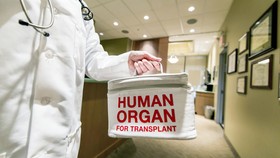 Pertama di Dunia, Cangkok Ginjal Lewat Vagina dengan Robot