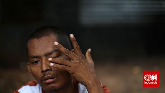 Tak cuma merusak otak, skizofrenia juga menimbulkan kerugian dan beban biaya yang tak sedikit.