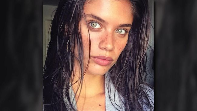 Perempuan cantik selalu digambarkan dengan kulit halus dan mulus. Oleh karenanya, sedikit bintik hitam di wajah bisa membuat perempuan jadi tak percaya diri.