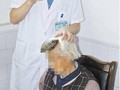 Nenek 'Unicorn' Hidup dengan Tanduk 12 Cm di Kepalanya