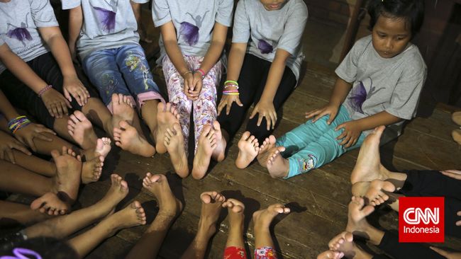 Mengingat kaki anak masih akan terus tumbuh, beberapa ahli podiatri menganjurkan membiarkan anak tumbuh tanpa terbatasi oleh sepatu.