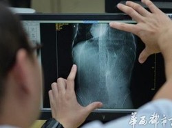 Mengeluh Sakit Perut, Ternyata Ada Kabel USB Nyangkut di Usus Remaja Ini