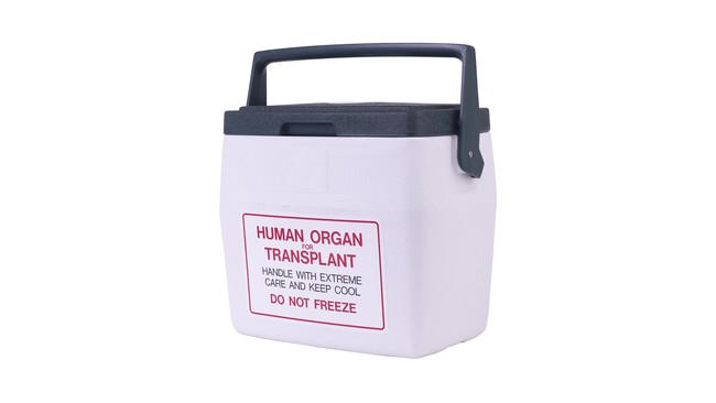 Kemiskinan membuat sebagian rela melakukan apa saja untuk mendapatkan uang, termasuk menjual organ tubuhnya sendiri. Jangan ditiru ya.