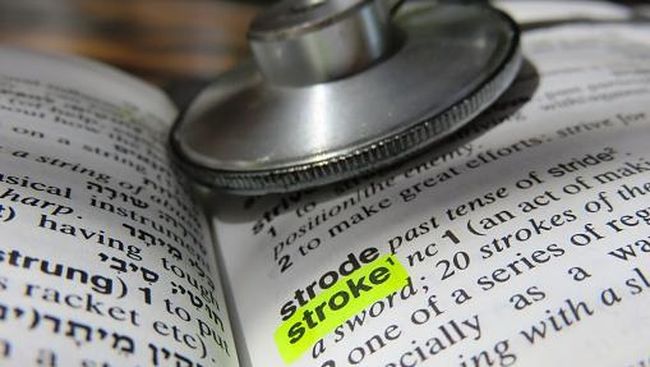 Fibrilasi atrium atau irama jantung tak teratur dapat meningkatkan risiko stroke, serta menyebabkan nyeri dada dan gagal jantung.