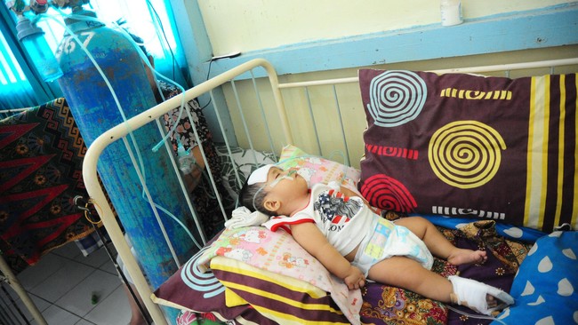 Tahapan kondisi kesehatan yang dialami warga terdampak kabut asap ialah: iritasi, batuk-pilek, ISPA, radang paru, dan jika tak tertangani bisa meninggal.