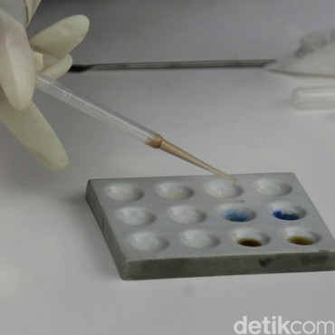 Aktor Ternama Korea Dilaporkan Gunakan Narkoba Jenis Propofol