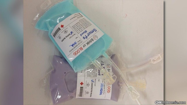 Kenali berbagai tipe wadah plastik yang aman untuk menyimpan daging kurban.