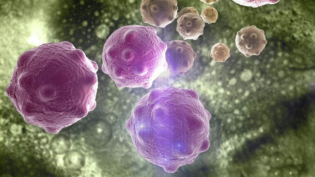 Karena tumor yang menggerogoti tubuh Hu Yongsheng, beberapa organ tubuhnya diganti dengan tujuh pelat titanium, 46 paku dan beberapa tulang semen di tubuh.