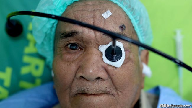 Katarak adalah salah satu penyebab kebutaan yang paling umum. Akan tetapi ada berbagai cara mencegah katarak yang bisa dilakukan.