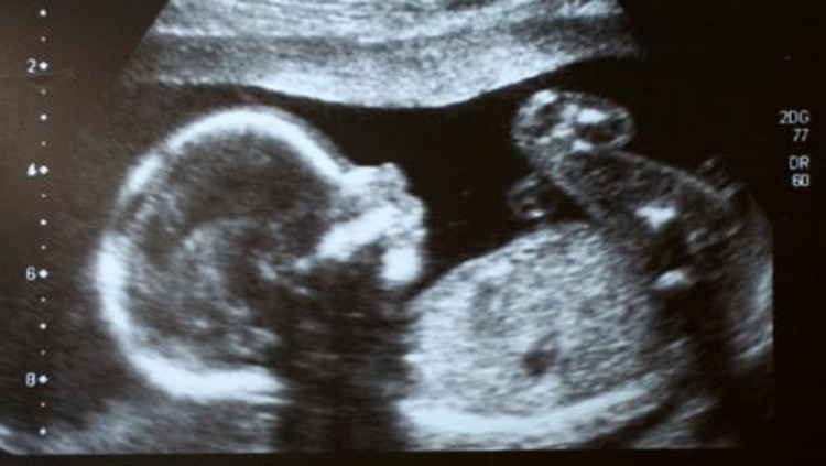 Ada yang bilang kalau janin suka menedang itu, katanya hamil anak laki-laki. Bener nggak sih, Bun?