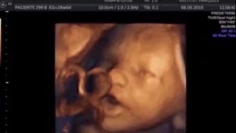 Pada tahap perkembangan janin di minggu ini, bayi mulai memiliki pola tidur-bangun teratur.