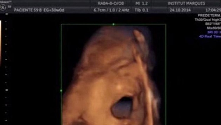 Pada tahap perkembangan janin di minggu ini, bayi mulai memiliki pola tidur-bangun teratur.