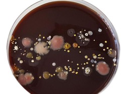 Ini 2 Jenis Bakteri Kebal Antibiotik yang Diungkap Kemenkes