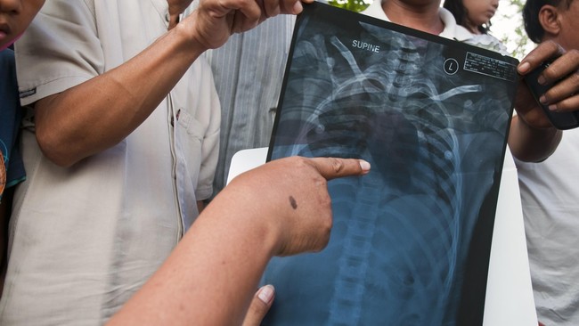 Naiknya tarif cukai rokok tahun depan dikaitkan dengan isu kesehatan menunjukkan pemerintah tidak empati pada rakyat kecil, salah satunya petani tembakau.