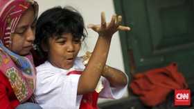 Enam Cara Orang Tua Menghadapi Anak Autis