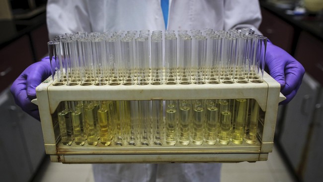 Ada beberapa jenis air keras yang biasa digunakan di laboratorium atau industri yang memakai bahan kimia. Dan bila terpapar manusia akan alami luka bakar.