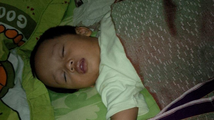Tahu nggak, Bun, gejala alergi pada anak bisa dilihat dari 3 area di tubuhnya. Mana saja itu?