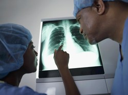 Dokter Ungkap Paru-paru Basah Bisa Menular, Ini Kelompok Paling Berisiko Terkena