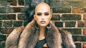 Kisah Haru Model Cantik Pengidap Kanker