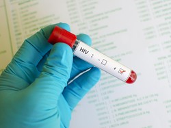 Prediksi Kemenkes Ada 500 Ribu Kasus HIV di RI, Terbanyak di Usia Ini