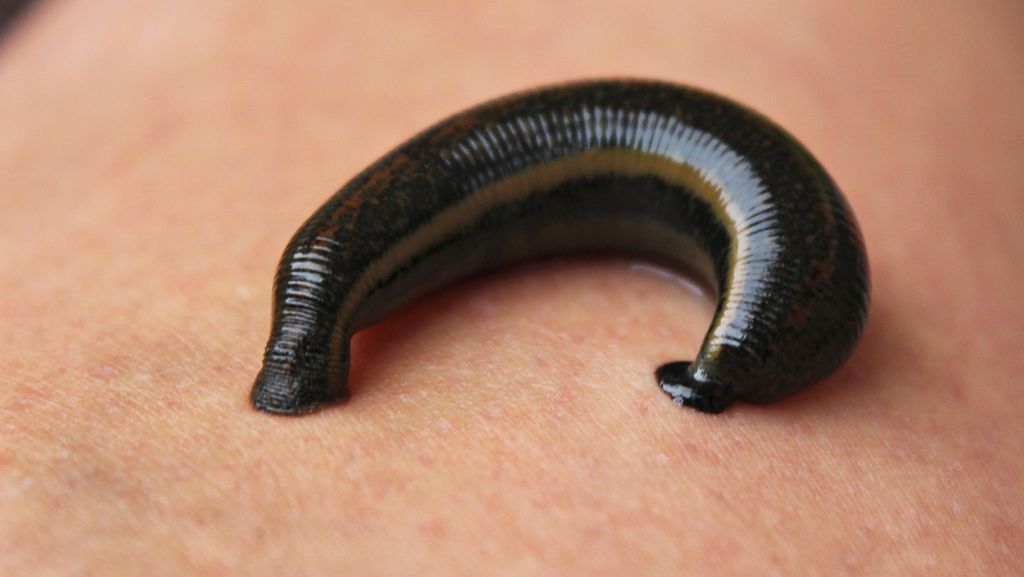 Mimisan Berhari-hari, Lintah Ditemukan Bersarang di Hidung Pria Ini