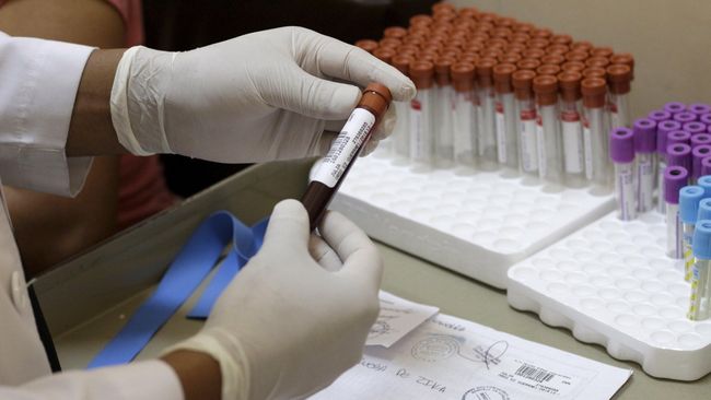 Gedung Putih menggelontorkan dana sekitar US$1,9 miliar untuk menghadapi virus Zika. Ia dianggap lebih berbahaya dari yang dipikirkan.