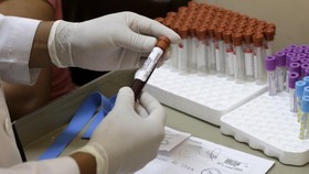 Amerika Mulai Meributkan Virus Zika
