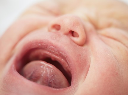 Bunda Perlu Tahu, Ini Penyebab Lidah Putih pada Bayi