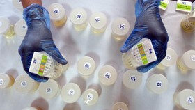 img-title Waspada Ginjal Akut, Kemenkes Minta Orang Tua Cek Volume Urine Anak