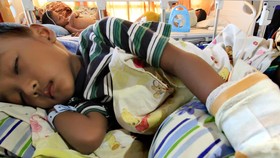 Orang Tua, Kenali Tanda Bahaya DBD pada Anak Sebelum Terlambat