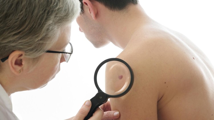 Keloid memang tak berbahaya buat kesehatan, hanya saja bisa mengganggu penampilan.