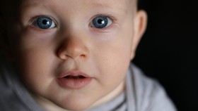 Cerita Orang Tua dengan Anak Penyintas Glaukoma Kongenital