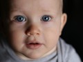 Hipotiroid Kongenital, Ancaman untuk Tumbuh Kembang Anak