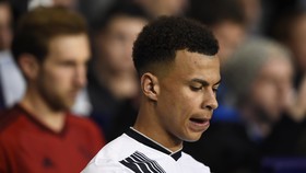Dele Alli Terancam Sanksi
