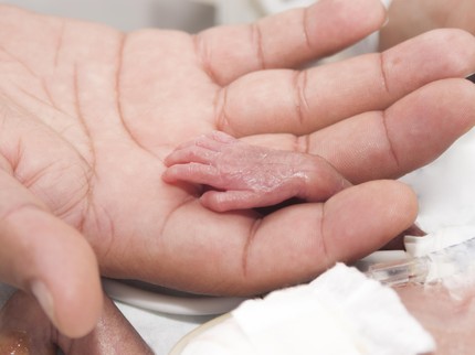 Cerita Ayah yang Anaknya Lahir Prematur di Kehamilan 25 Minggu
