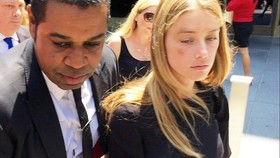 Wajah Lebam Amber Heard Memicu Spekulasi Manipulasi