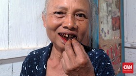 Setengah Abad 'Nginang' Jadi Candu Sumaryati